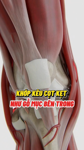 Cải thiện đau khớp với Anbone - Viên khớp chính hãng Traphaco Combo 3 hộp (loại 30 viên)