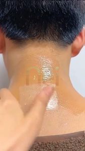 Perontok Daki Instan Tanpa Rasa Sakit - Pemutih Kulit Murah NEI Peeling Spray 90 ml