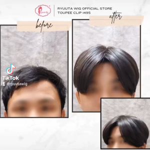 Ryuuta Wig Toupee Clip Poni Penutup Botak Pendek 011495
