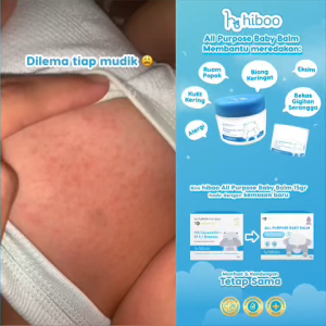 hiboo All Purpose Baby Balm [Set 15g + 5g] 10% Coconut Oil Vit E Beeswax - Japan Natural Nourishing Calming Moisturizer - Balsem Salep Anak Ruam Popok Skincare A55