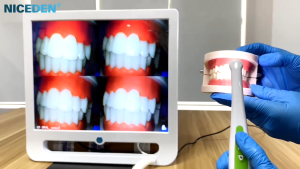 Dental Equipment Oral Camera Wireless WiFi Real-Time Transmission High-definition  Dental Camera Monitor Oral Camera