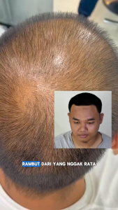 FLO Shampo untuk Rambut Rontok Menghitamkan Rambut - Anti Ketombe - Melembabkan Rambut Kusut Kering
