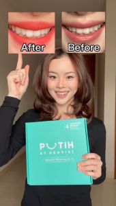 PUTIH BY DENTIST Custom Fit Mouth Tray