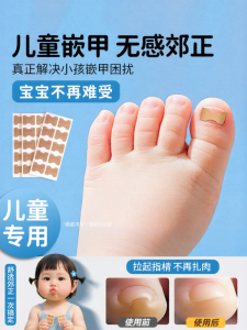 IMLUCKY | Nail Correction Patches For Children To Prevent Ingrown Toenails