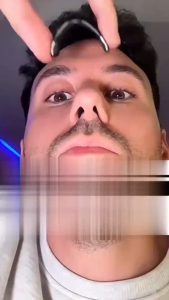 BW-C1435 Noseclip Plester Hidung Magnetik / Klip Hidung Penghilang Ngorok Alat Anti Dengkur