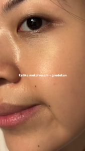 WHITELAB Brightening Serum Wajah Menyamarkan Noda Hitam 20ml XX340