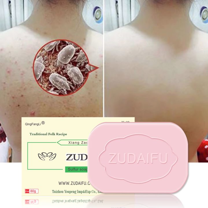 ZUDAIFU OFFICIAL SOURE 100% Original ZUDAIFU Shampoo 300ml Anti ...