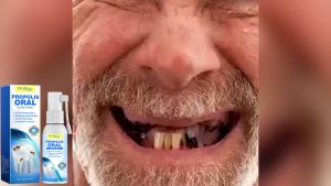 Oralhoe สเปรย์สำหรับช่องปาก Propolis Oral Instant Spray ช่วยให้ปากสะอาด สดชื่นยาวนาน ขจัดคราบหินปูน ทำให้ฟันขาวขึ้น ฟันสวย พ่นช่องปาก Mouth Herb Spray ลดกลิ่นปาก สเปรย์พ่นช่องปากโพรโพลิส