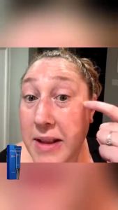 Kem Tan Bọng Mắt Openeyes - Kem Mắt Openeyes Mờ Thâm Mắt Nâng Cơ Xóa Nhăn Vết Chân Chim Hiệu Quả