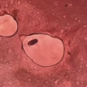 Green Remedy Dust Mite Spray สเปรย์กำจัดไรฝุ่น ตัวเรือด ออร์แกนิค รับรองโดยสถาบันวิจัย ปลอดภัยกับเด็กสัตว์เลี้ยง