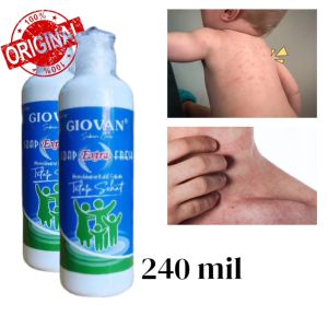 Giovan Sabun Cair: Solusi Gatal-Gatal Akibat Biang Keringat