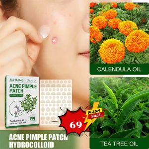 พร้อมส่ง!!แผ่นแปะสิวJaysuing ขนาด 1กล่องมี 144 ชิ้น