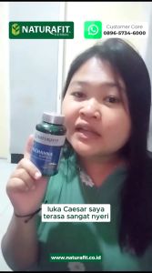 Alchanna Naturafit Kapsul Ekstrak Albumin Ikan Gabus Kutuk Asli Original Cepat Keringkan Luka Pasca Caesar - isi 30 & 60 Kapsul
