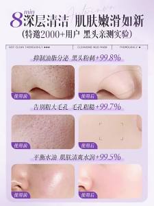 CKCU | Mặt Nạ Bùn Làm Sạch Sâu Giảm Lỗ Chân Lông và Loại Bỏ Mụn Đầu Đen