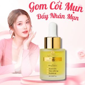 Serum Doctor Care Acne 7ml/20ml – Tinh Chất Chăm Sóc Da Dầu Dễ Nổi Mụn Hỗ Trợ Thông Thoáng Lỗ Chân Lông