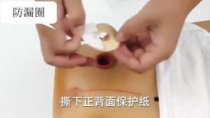 10pcs colostomy bag leak-proof ring ointment stoma ring stoma care protection skin stoma ring bottom plate 2mm