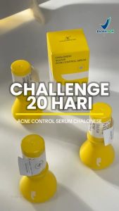 BPOM CHALONESE Obat jerawat dan bekas jerawat penghilang salep obat paling ampuh removal of acne cream untuk pria dan wanita menghilangkan dengan cepat