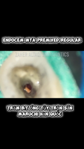 Endocem MTA - Vật Liệu Che Tủy Trộn Sẵn Maruchi Hàn Quốc Ống 2g
