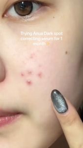 Anua 10% Niacinamide + 4% TXA Dark Spot Correcting Serum Whitening Brightening Essence 30ml