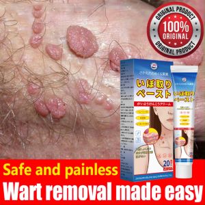 Warts Remover Cream Private Genital Warts Remover Cream Painless Wart Treatment Cream for Millia Syringoma Mole Remover Warts Remover Herbal Extract Natural Wart Removal