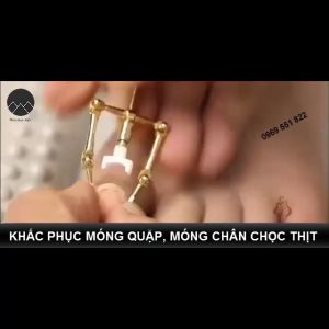 BỘ DỤNG CỤ CHỮA MÓNG CHÂN BỊ CHỌC THỊT GÂY TỔN THƯƠNG ĐAU ĐƠN -MÓNG CHÂN BỊ QUẶP THỊT ( LOẠI 2 )