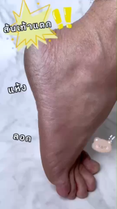 TRENDY - เซ็ตแปรงและหินขัดส้นเท้า (TD1062-200GD)