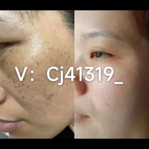 💗🙋♀️💗净疤膏美容院修护各类疤痕增生疤烧伤烫伤剖腹产疤凹凸疤源头厂家