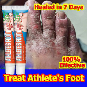 【Buy 1 Take 1】Athletes Foot Treatment Cream  Anti Fungal Cream  Anti-Fungal Treatment Cream Foot Odor Beriberi Ointment Fungus Inhibitor Cream 20g
