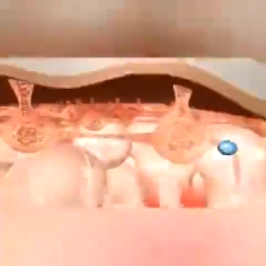 [100%ORI] Stretch Mark Removal Obesity Lines Remover Postpartum Stretch Marks Maternity Skin Repair Treatment Scar Remover Cream Lighten Pigmentation