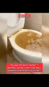 Serbuk Bubuk Anti Sumbat Pipa Pembersih Saluran Air Toilet Wastafel WC Penyumbatan Mampet Soda Api