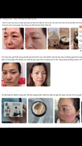 [Mua 1 Tặng 1] Kem Trắng Da Mờ Nám Tàn Nhang Đốm Nâu Giúp Da Đều Màu Sáng Mịn Tự Nhiên An Toàn Không Bào Mòn Da - Spot Removing Cream 30g - Thảo Dược Mờ Nám Tàn Nhang Nội Địa Trung