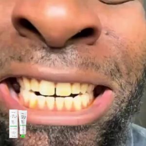 oralhoe | Hydroxyapatite Toothpaste Enamel Repair Oral Hygiene Cleaning Stain Removal Fresh Breath Hydroxyapatite Brightening Toothpaste