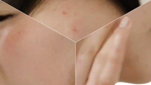 COSRX Salicylic Acid Daily Gentle Cleanser Acne Treatment Cleanser for Acne-prone Skin 150ml