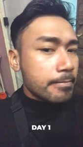 Beard Serum Brewok Kumis Jambang Alis Hasil Cepat Ampuh Permanen Beard Serum Green Angelica Original