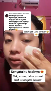 HIQWEEN RETINOL BRIGHTENING SOAP Face Facial Wash Sabun Cuci Muka Badan Retinol Memutihkan Arbutin Kotoran Membersihkan Mencerahkan Wajah Hitam