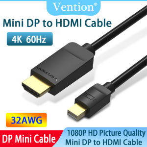 Vention 1.2 Mini Display Port to HDMI Cable 4K Thunderbolt to HDMI Cable for MacBook Air Pro Surface Monitor Projector Mini DP to HD 1080P Computer TV Adapter