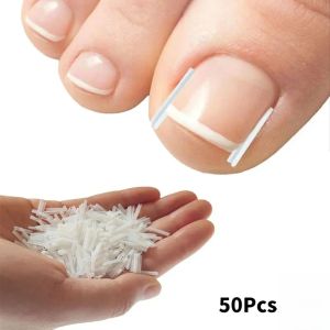 50Pcs Ingrown Toenail Correction Tool Ingrown Toe Nail Treatment Elastic Patch Sticker Straightening Clip Brace Pedicure Tool