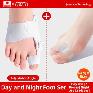 FROTH | Toe Alignment Bunion Corrector
