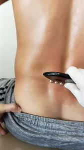 Lược Bạc Hình Cá Chải Thông Kinh Lạc Dụng Cụ Diện Chẩn