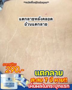 Lana Rich อาร์บูตินเพียว ครีมกลูต้า ข า วไ ว X10 ฟื้นฟูผิวกระจ่างใส ลดรอยแตกลาย น้ำเหลืองไม่ดี สิวที่หลัง