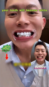 Vĩnh viễn làm trắng bạc hà hương vị làm trắng kem đánh răng Probiotic kem đánh răng làm mới miệng làm trắng răng nhẹ nhàng không gây hại men răng loại bỏ vết ố vàng 100g