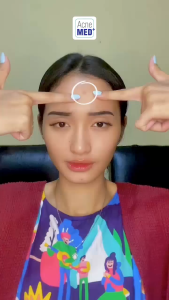 Promo Acnemed Blackhead Nose Mask 15 Gram(Nose Blackhead Remover)| Nose Blackhed Nose | Masker Hidung Berkomedo | Bebas Komedo | Bersih Dari Komedo | Hidung Bersih Dari Komedo | Komedo Bandel Hilang