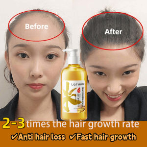 【Local Seller】anti hair loss shampoo Hair growth shampoo 500ml Hair care for all hair types ginger shampoo for hair loss Anti andruff and oil control shampoo
