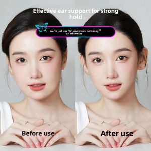 Invisible Small Face Fixing Ear Correction Device