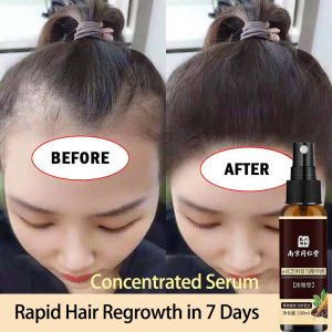Hair Tonic hair growth spray 100ml white hair turns black serum hair loss treatment Improve hair follicles Nourish hair roots 100ml Repair activation hair growth Herbal essence nutrition 同仁堂生发精华液 防脱发 白发变黑发