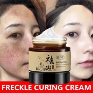 Penghilang Flek Hitam & Penghapusan Bekas Jerawat Efektif