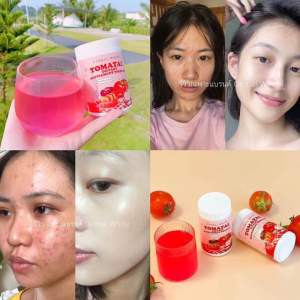 Global White Tomatal Supplement အသားဖြူချင်သူများ အတွက် လူကြိုက်များတဲ့ အသားဖြူဆေး 🍅