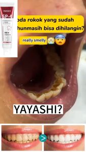 ( FREE TEETHBRUSH YAYASHI)SP4 Ultra Plus Super Probiotic Whitening Toothpaste Fresh Breath Ubat Gigi Probiotik Permutihan Gigi Gluten Free