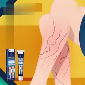 ครีมทาเส้นเลือดขอด ครีมเส้นเลือด ยาทาเส้นขอด เส้นเลือดขอด รักษาขาให้สวย รักษาขาให้สวย ครีมหลอดเลือดดำบอกล