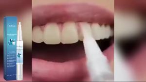 oralhoe | Teeth Whitening Gel Pen for Yellow Stain Removal and Fresh Breath Improve Oral Odor Cleaning Teeth Portable Oral Gum Care 4ml